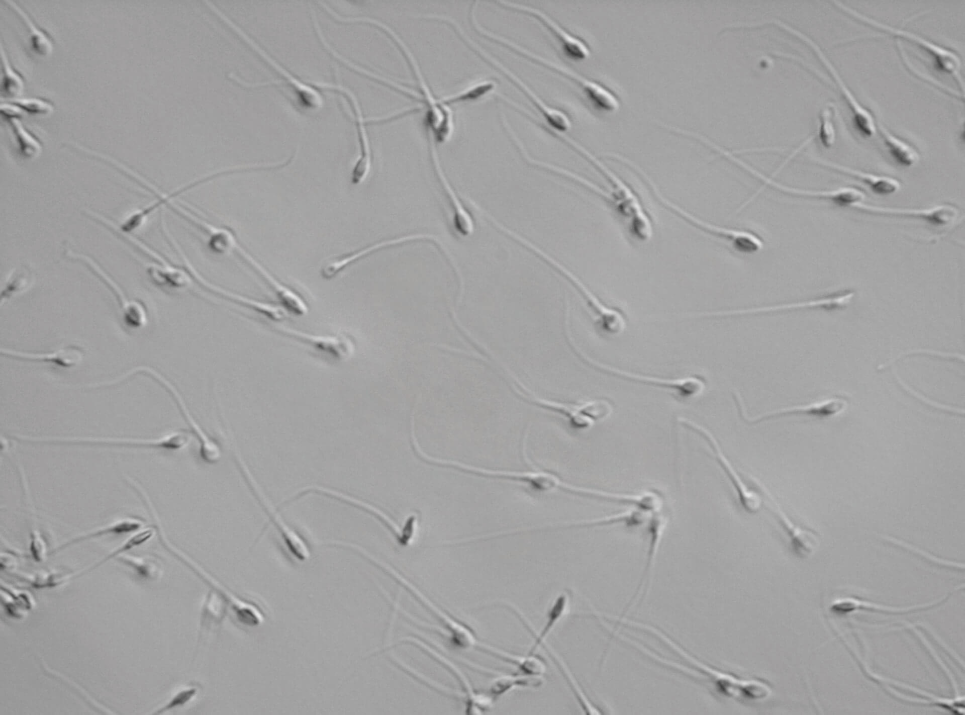 Abnormal Sperm Morphology Naturehill