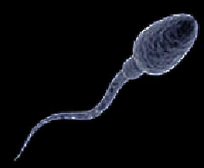 sperm under microscope