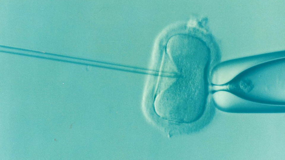 HOW LONG CAN SPERM LIVE INSIDE THE FEMALE BODY