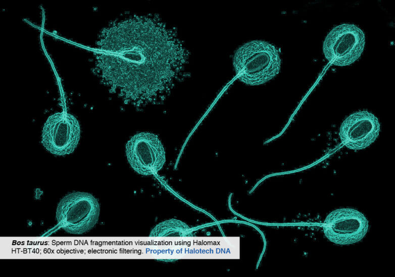 Is Sperm DNA Fragmentation Testing Still Relevant In Male Infertility diagnosis?